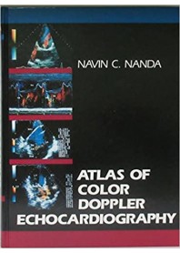 Atlas of Color Doppler Echocardiography di Nanda
