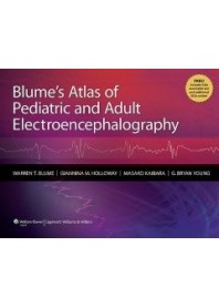 Blume's Atlas Of Pediatric And Adult Electroencephalography [With Access Code] di W. T. Blume, M. Kaibara, G. M. Holloway
